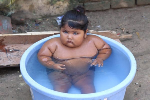 Cuộc sống hiện tại của bé gái Ấn Độ 8 tháng tuổi nặng 17kg - Ảnh 8